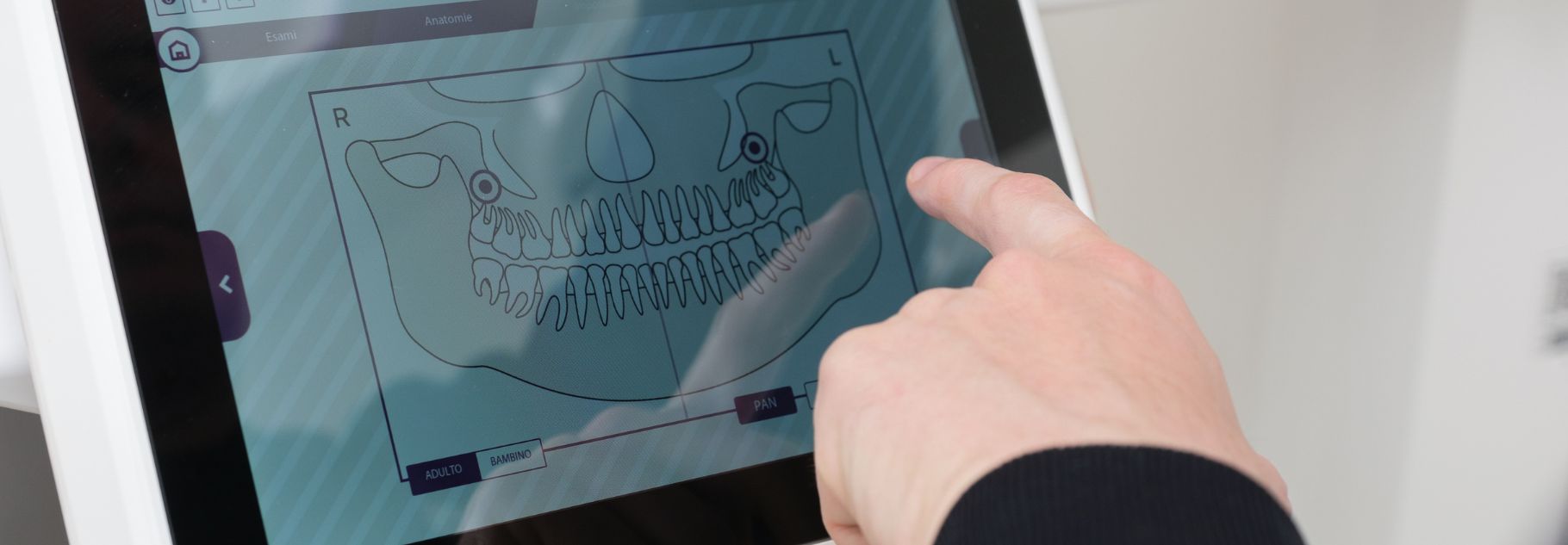 Le Migliori Tecnologie Odontoiatriche Al Tuo Servizio - Dental Hub