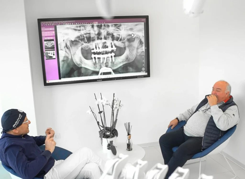 Impianti dentali per tutta l’arcata