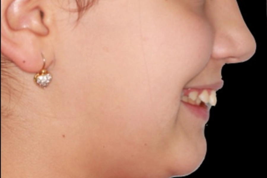 Casi clinici 7 Dental Hub - Studio dentistico ad Anzano e Arosio
