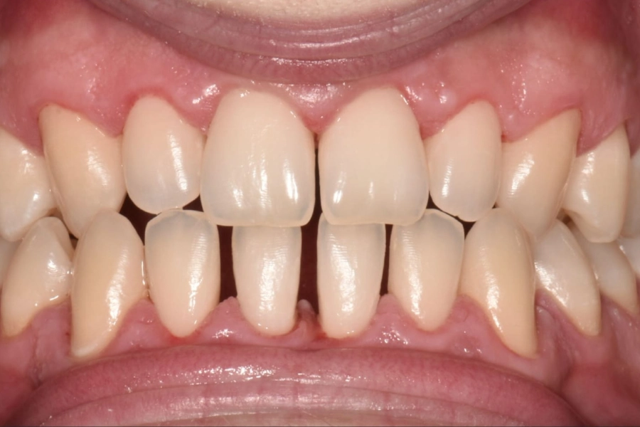 Dental Hub - Studio dentistico ad Anzano e Arosio
