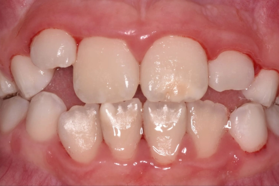 Dental Hub - Studio dentistico ad Anzano e Arosio