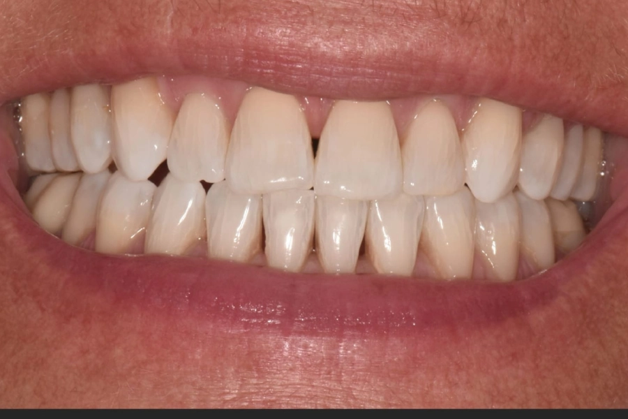 Dental Hub - Studio dentistico ad Anzano e Arosio