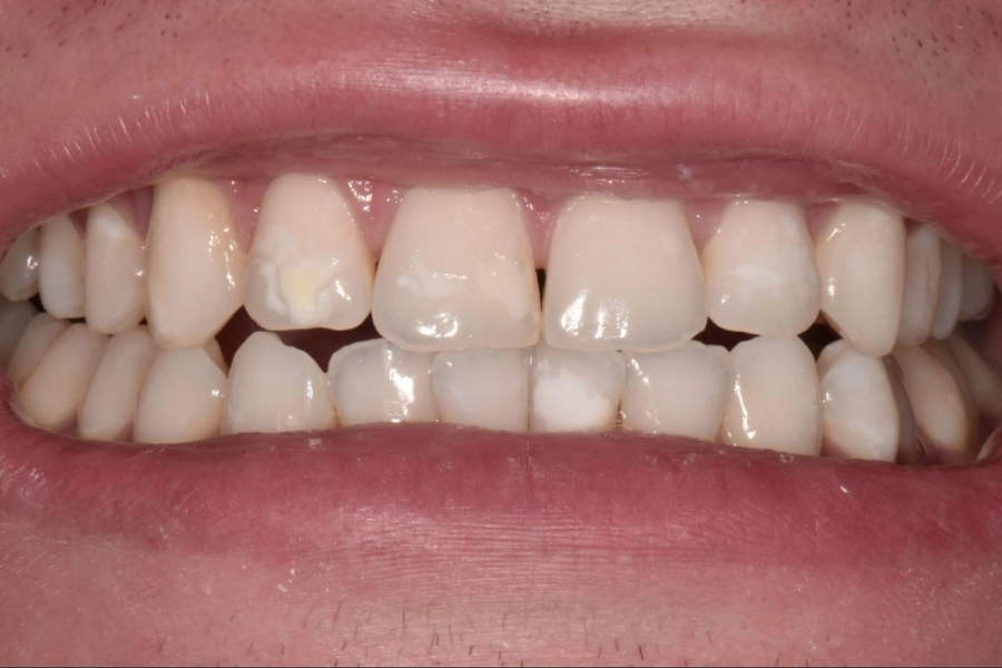 Dental Hub - Studio dentistico ad Anzano e Arosio