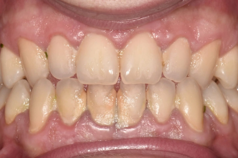 Dental Hub - Studio dentistico ad Anzano e Arosio