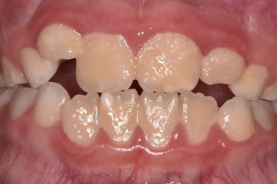 Dental Hub - Studio dentistico ad Anzano e Arosio
