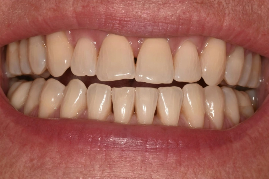 Dental Hub - Studio dentistico ad Anzano e Arosio