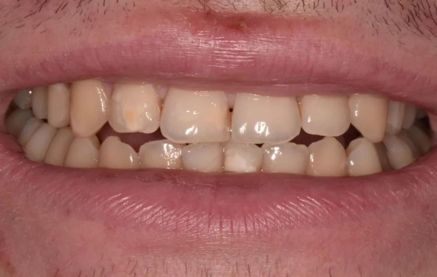 Dental Hub - Studio dentistico ad Anzano e Arosio