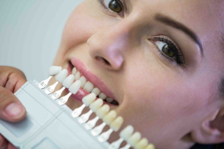 Glossario Odontoiatrico 1 glossario odontoiatria estetica